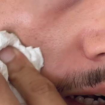 Exfoliante Peel Shot Arroz Negro